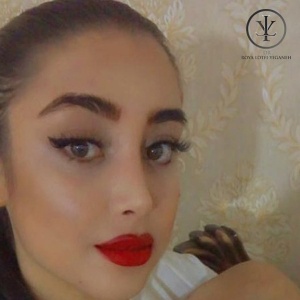 جراحی-بینی-11