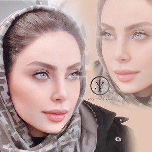 جراحی-بینی-19