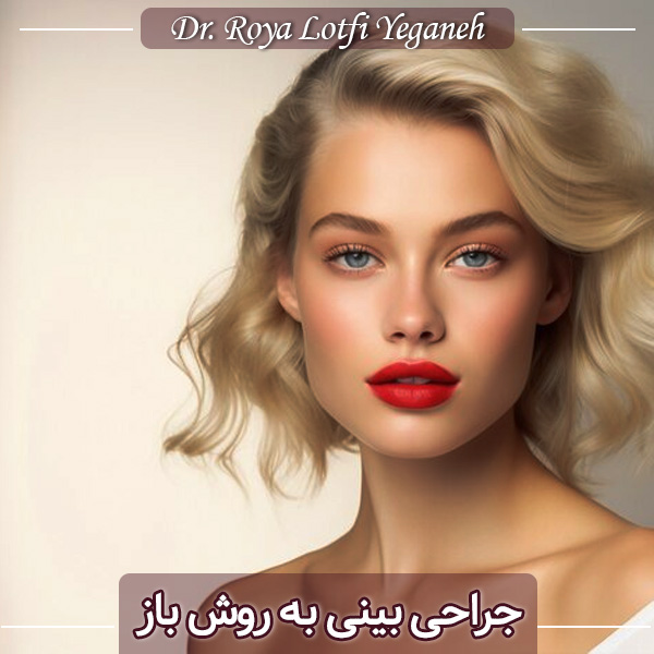 جراحی بینی باز