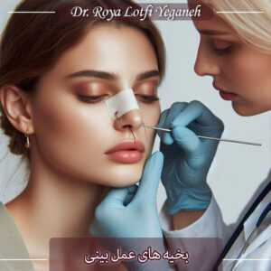 بخیه های عمل بینی - دکتر رویا لطفی