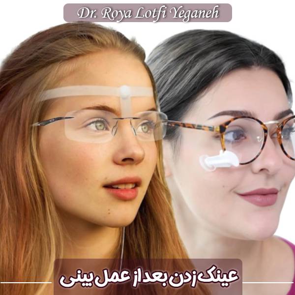 عینک زدن بعد از جراحی بینی