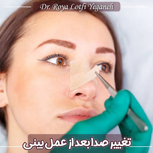 تغییر صدا بعد از عمل بینی