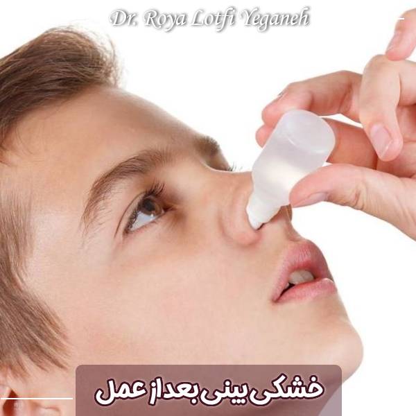 خشکی بینی بعد از عمل 