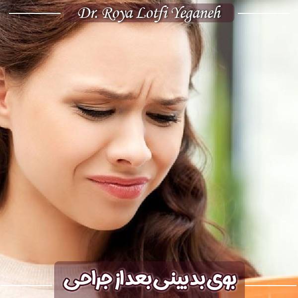 بوی بد بینی بعد از جراحی