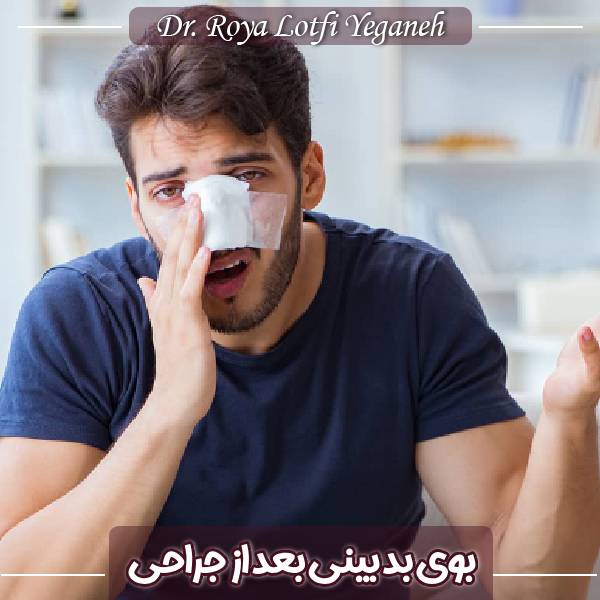 درمان بوی بینی بعد از جراحی
